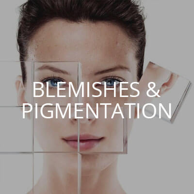 Blemishes & Pigmentation